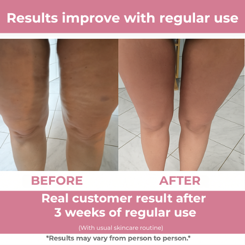 FirmFlex Pro
